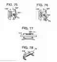 Fig. 34 - Orthodontic bracket