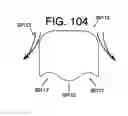 Fig. 56 - Orthodontic bracket