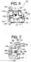 Fig. 06 - ORTHODONTIC BRACKET