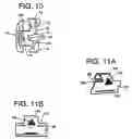 Fig. 08 - ORTHODONTIC BRACKET
