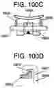 Fig. 52 - ORTHODONTIC BRACKET