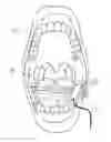 Fig. 01 - Inside Mouth Dental Light