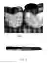 Fig. 02 - Dental instruments having durable coatings