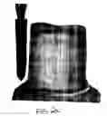Fig. 03 - Dental instruments having durable coatings