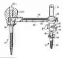Fig. 01 - Components for permanent removable and adjustable dentures and bridges