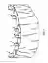 Fig. 02 - Components for permanent removable and adjustable dentures and bridges