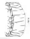 Fig. 03 - Components for permanent removable and adjustable dentures and bridges