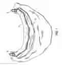 Fig. 05 - Components for permanent removable and adjustable dentures and bridges