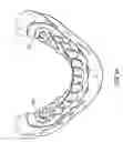 Fig. 10 - Components for permanent removable and adjustable dentures and bridges