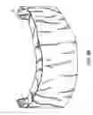 Fig. 11 - Components for permanent removable and adjustable dentures and bridges