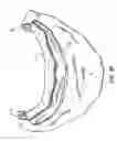 Fig. 15 - Components for permanent removable and adjustable dentures and bridges
