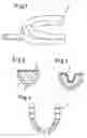 Fig. 02 - Method and impression tray for producing a dental mold