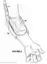 Fig. 07 - Phlebotomy training device