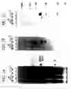Fig. 02 - Self-assembling recombinant papillomavirus capsid proteins