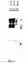 Fig. 06 - Secreted proteins and polynucleotides encoding them