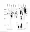 Fig. 02 - Composition for the diagnosis of retinal vascular disease comprising aldolase and method for diagnosis using it
