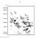 Fig. 03 - Composition for the diagnosis of retinal vascular disease comprising aldolase and method for diagnosis using it