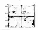 Fig. 04 - Composition for the diagnosis of retinal vascular disease comprising aldolase and method for diagnosis using it