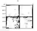 Fig. 06 - Composition for the diagnosis of retinal vascular disease comprising aldolase and method for diagnosis using it
