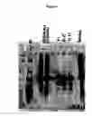 Fig. 07 - Thrombin purification