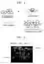 Fig. 02 - Cell separation method and kit using phase separation