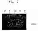 Fig. 06 - Cell separation method and kit using phase separation