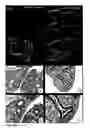 Fig. 02 - Inhibition of stem cell differentiation, enhancement of proliferation and selective induction of apoptosis by WNT factors