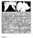 Fig. 04 - Inhibition of stem cell differentiation, enhancement of proliferation and selective induction of apoptosis by WNT factors