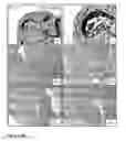 Fig. 08 - Inhibition of stem cell differentiation, enhancement of proliferation and selective induction of apoptosis by WNT factors
