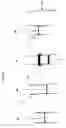 Fig. 04 - MBTH for aliphatic aldehyde measurement