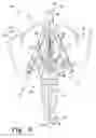 Fig. 07 - Flying toy with extending wings