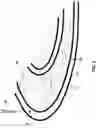 Fig. 03 - Golf practice device