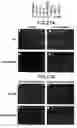 Fig. 43 - Androgen receptor coregulators
