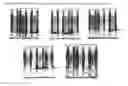 Fig. 27 - Method of treatment using adiponectin variants