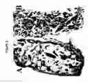 Fig. 03 - Mutants of bone morphogenetic proteins
