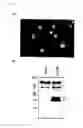 Fig. 05 - Genes and polypeptides relating to human pancreatic cancers