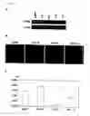 Fig. 06 - Genes and polypeptides relating to human pancreatic cancers