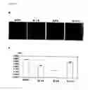 Fig. 07 - Genes and polypeptides relating to human pancreatic cancers