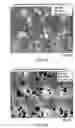 Fig. 42 - Crystalline forms of ziprasidone mesylate