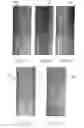 Fig. 16 - Systems and methods for controlling and forming polymer gels