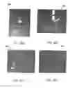 Fig. 19 - Systems and methods for controlling and forming polymer gels