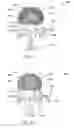Fig. 32 - Systems and methods for controlling and forming polymer gels