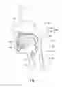 Fig. 02 - Systems and methods for moving and/or restraining tissue in the oral cavity