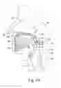 Fig. 06 - Systems and methods for moving and/or restraining tissue in the oral cavity