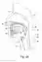 Fig. 07 - Systems and methods for moving and/or restraining tissue in the oral cavity