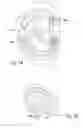 Fig. 09 - Systems and methods for moving and/or restraining tissue in the oral cavity