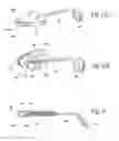 Fig. 12 - Systems and methods for moving and/or restraining tissue in the oral cavity