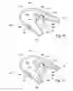 Fig. 15 - Systems and methods for moving and/or restraining tissue in the oral cavity