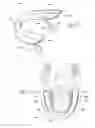 Fig. 17 - Systems and methods for moving and/or restraining tissue in the oral cavity