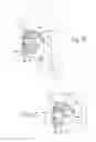 Fig. 19 - Systems and methods for moving and/or restraining tissue in the oral cavity